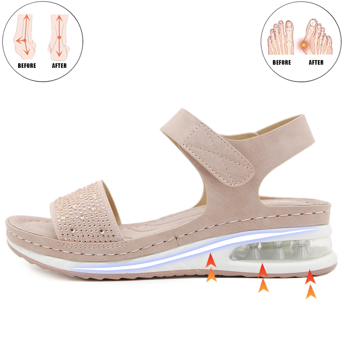 2024 New Womens Comfortable Orthopedic Sandals Arch Support-Bunion